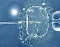 孕早期怎么判断单胎还是双胎？